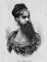 Annie Jones, bekend als de Esau Dame